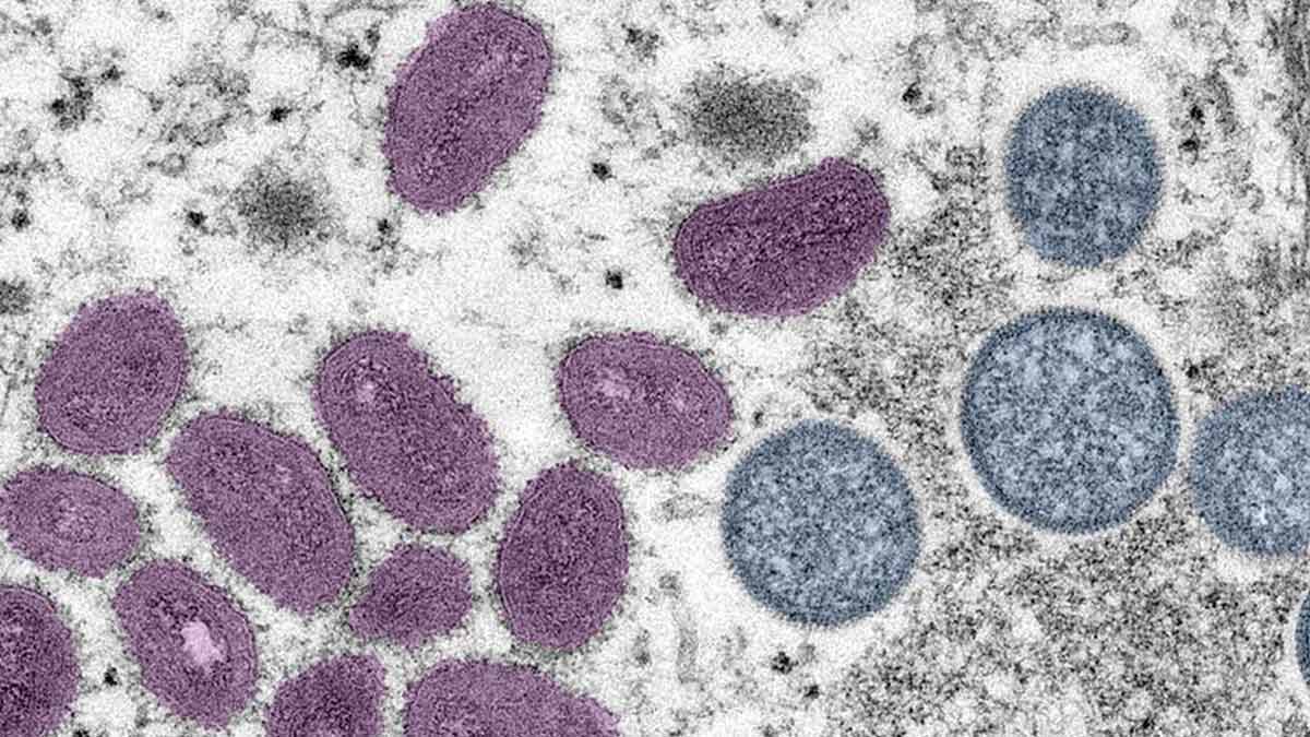 OMS levanta la alerta máxima mundial por brote de Mpox