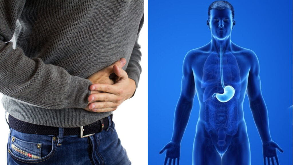 cáncer de estómago