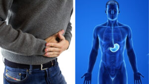 Cáncer de estómago, ¿qué es y cómo afecta la enfermedad que padece Xava Drago?