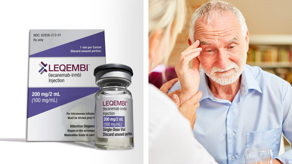 Aprueban a Leqembi para tratar el Alzheimer temprano