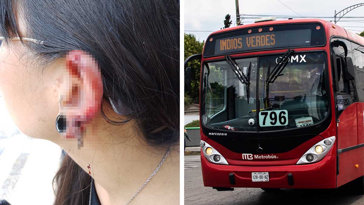 “Nadie me ayudó”, mujer denuncia que un sujeto le arrancó un pedazo de oreja en el Metrobús