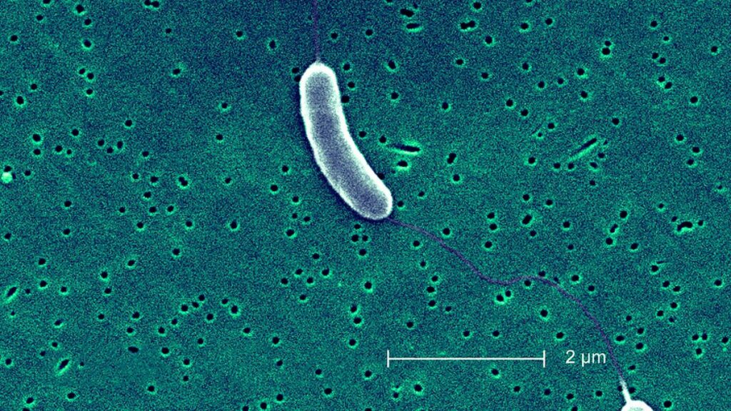Aspecto microscopico de la bacteria Vibrio Vulnificus.
