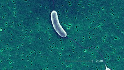 Aspecto microscopico de la bacteria Vibrio Vulnificus.