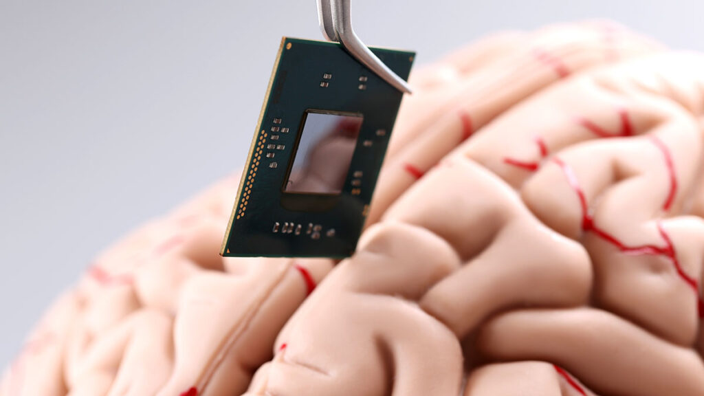 implantes cerebrales