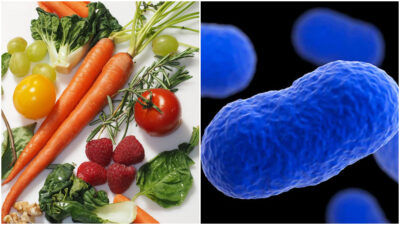 Lis¿Qué es la Listeria y qué causa esta infección grave?