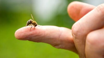 Qué hacer si me pica una abeja