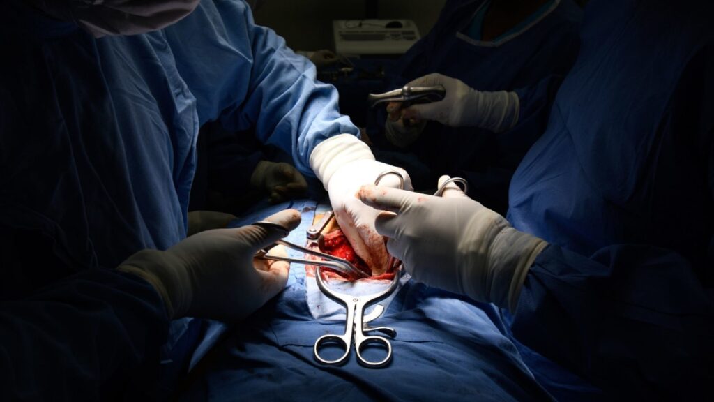 Día Nacional de la Donación y Trasplante de Órganos y Tejidos: 19 mil 750 mexicanos esperan un órgano