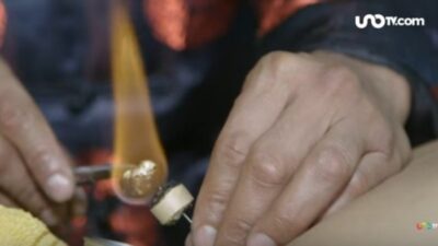 Técnica de moxibustión aplicada a paciente para quitar el dolor