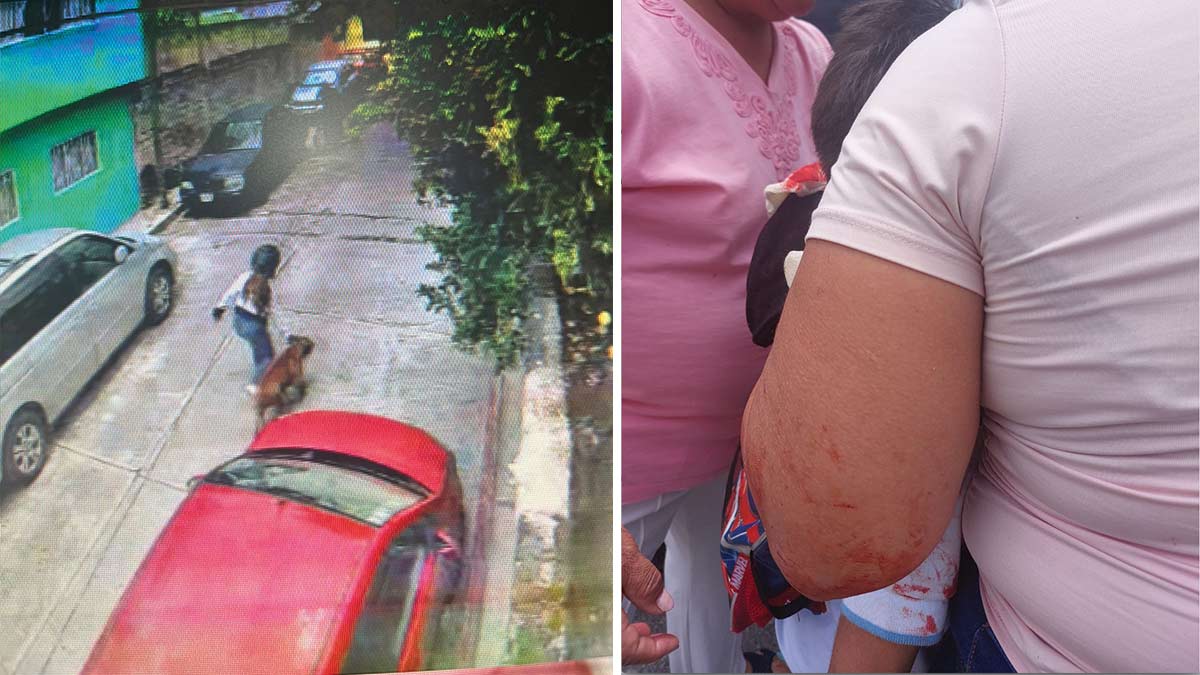Ataca pitbull a niño de 5 años en Jiutepec, Morelos