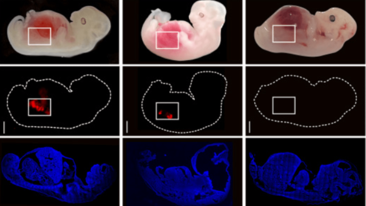 Científicos generan el primer órgano humano dentro de un animal: ¿qué representa esto para los trasplantes?