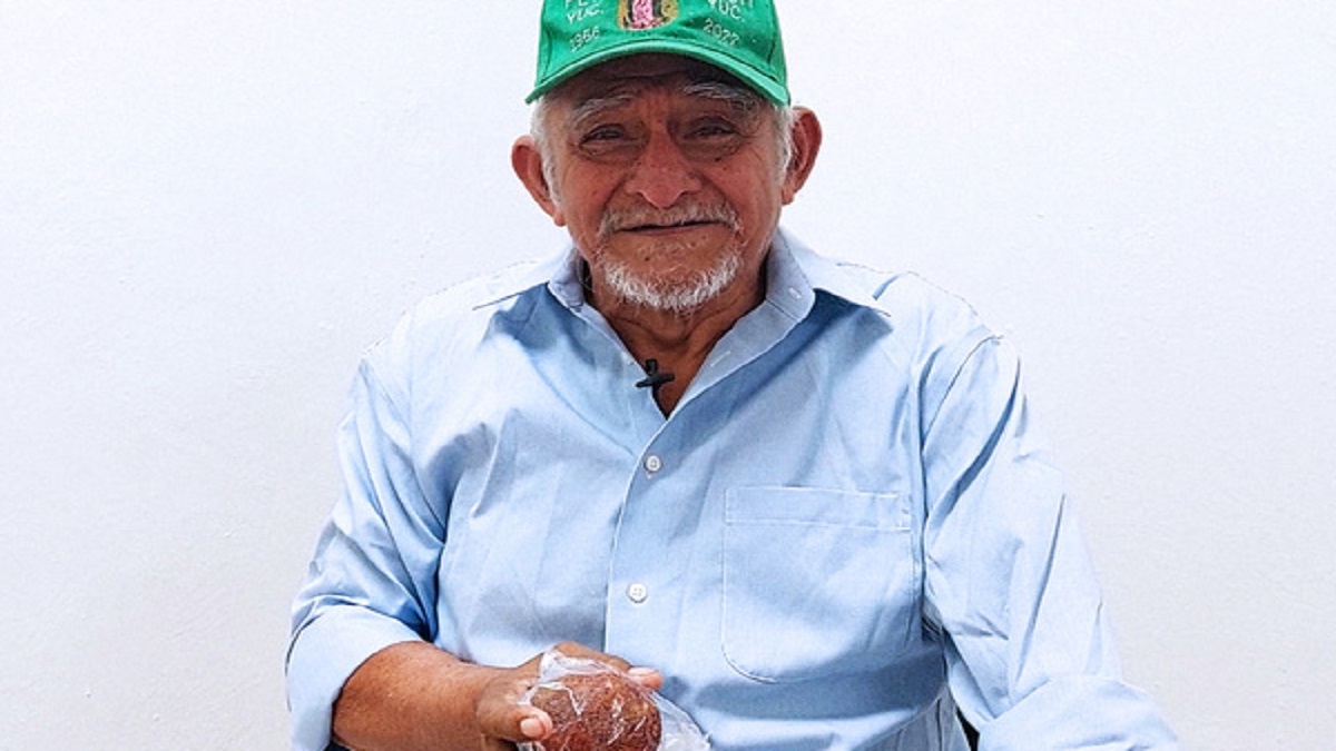 Extraen piedra gigante de 250 gramos de vejiga de adulto mayor en Yucatán