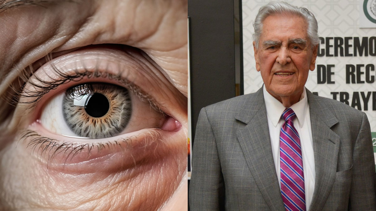 Degeneración macular, ¿qué es esta enfermedad ocular que padece Eric del Castillo?