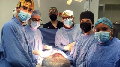 En León, extirpan tumor de 21 kilos a mujer de 60 años en el IMSS