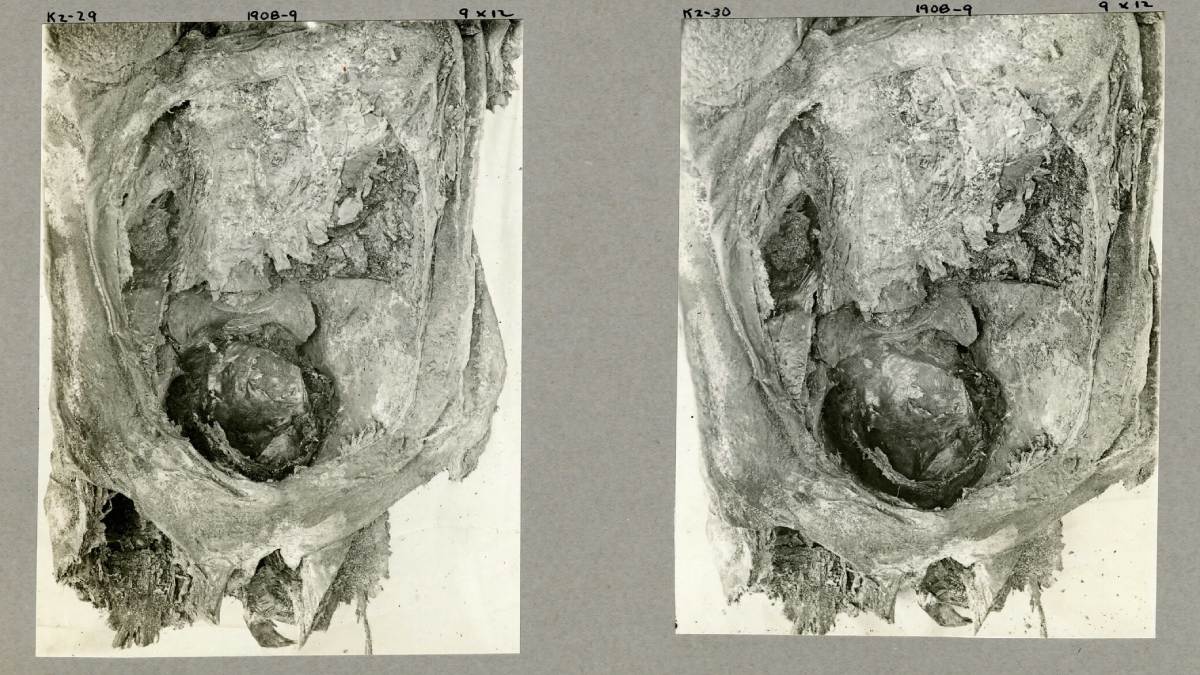 Momia adolescente de 2 mil años murió mientras daba a luz a gemelos: fotos