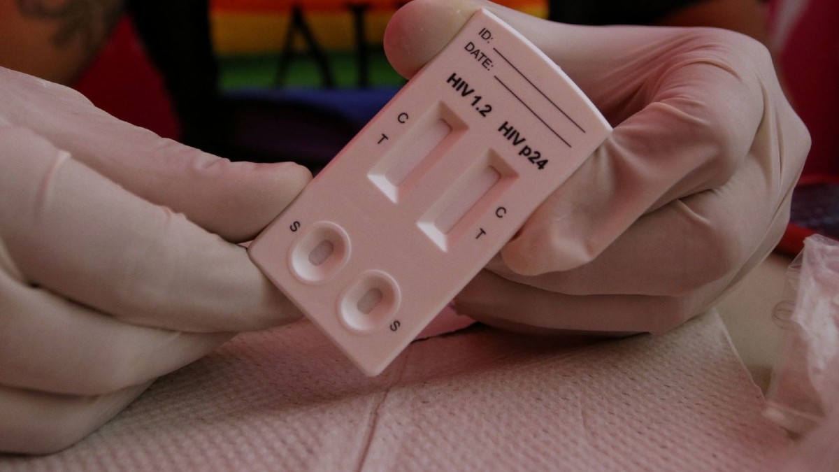 Cofepris autoriza uso de autoprueba para diagnóstico de VIH