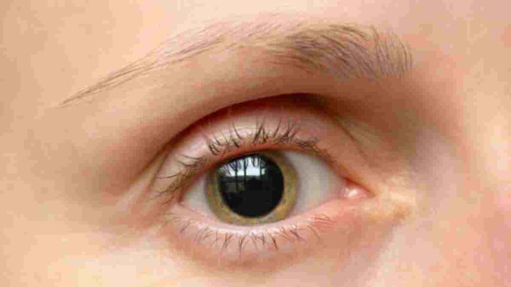 Injerto de cejas: lo que debes de saber de este procedimiento