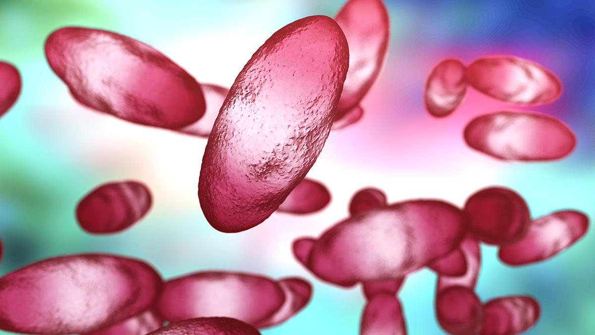 Reportan primer caso de peste bubónica en Oregón en casi una década, ve los principales síntomas
