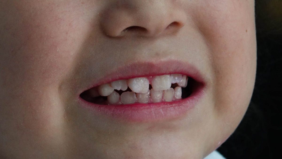 Dentistas a las escuelas: Cuidan salud bucal de alumnos en 700 planteles de educación básica en la CDMX