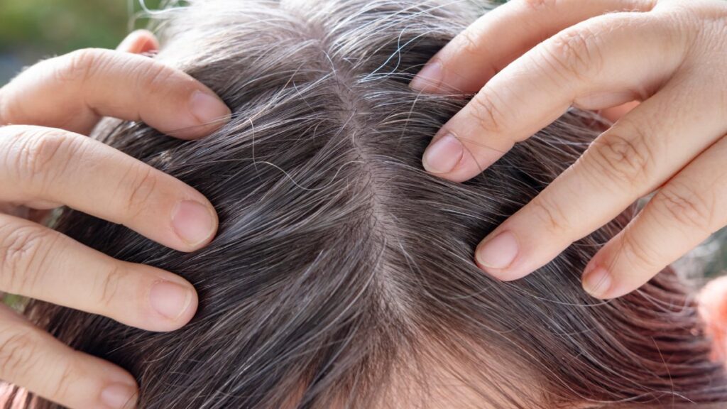 Persona rascándose la cabeza con cabello con canas