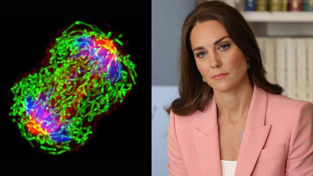 ¿Por qué el cáncer afecta cada vez más a menores de 50 años, como a Kate Middleton?