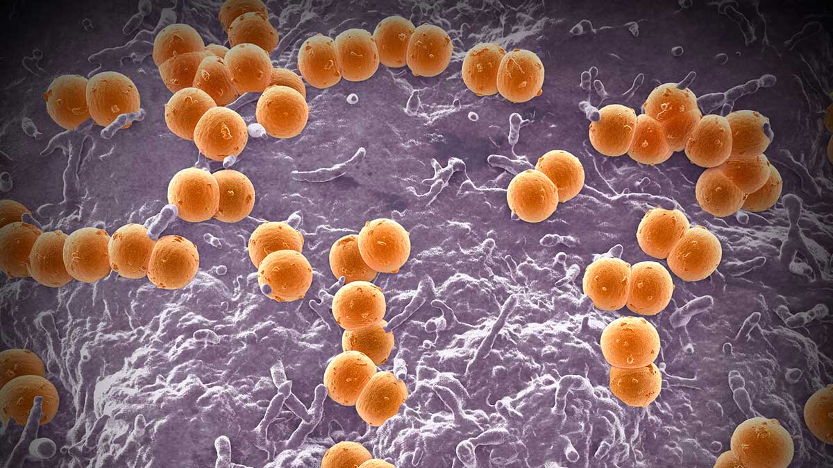 Los CDC advierten a médicos sobre una rara infección grave