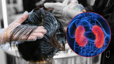 Mujer sufre daño renal tras un tratamiento para alaciar el cabello, alertan por sustancia en estos productos