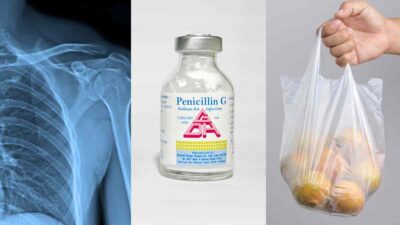 rayos x, penicilina y plástico son inventos descubiertos por accidente