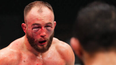 Rebecki, estrella de UFC terminó con la cara desfigurada tras perder por nocaut: la comparación de su rostro que se hizo viral