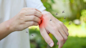 Llega lluvia y acecha dengue: 59% de casos, en estos 5 estados