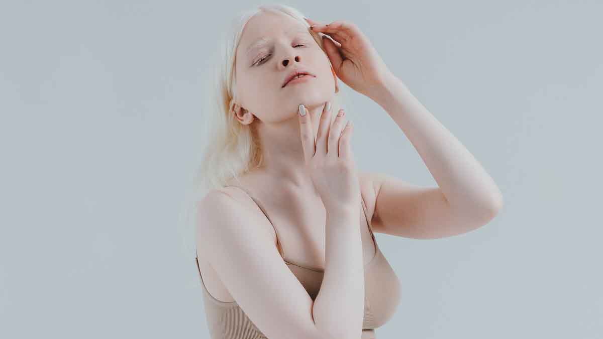 ¿Por qué hay personas albinas?
