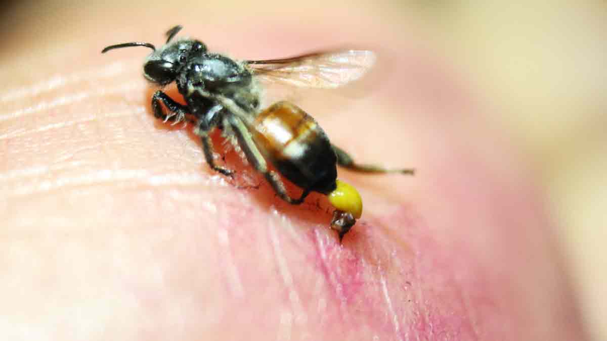 ¿Qué reacciones causan las picaduras de abeja y cómo saber si es una grave?