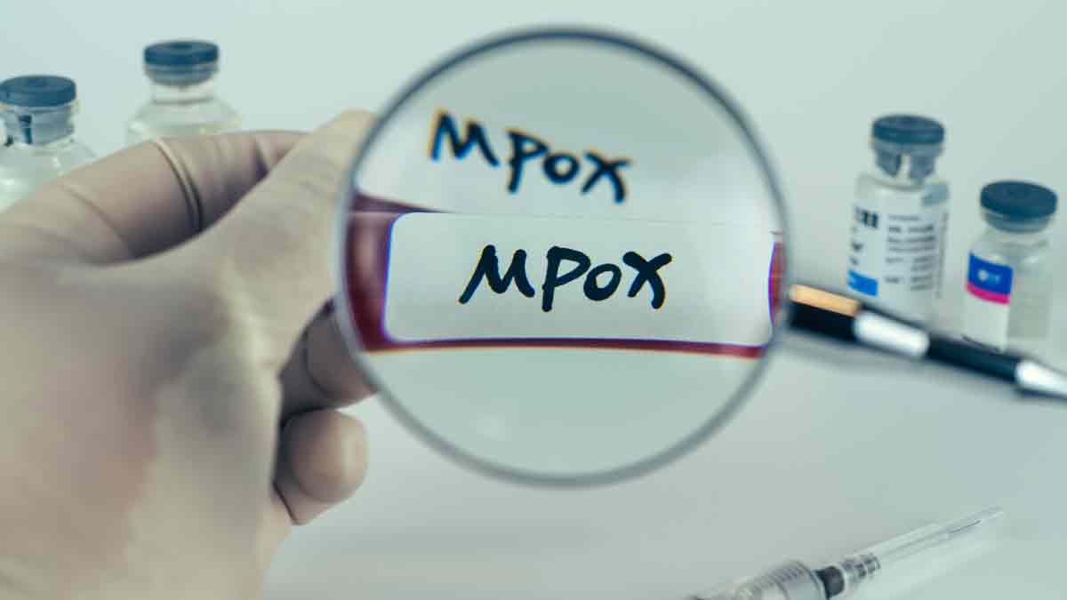 Nueva cepa de la “mpox” preocupa a la OMS, esto se sabe
