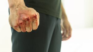 Joven golpea a chofer de Agua Caliente, Tijuana, por no bajarlo donde quería