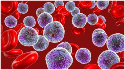 UNAM impulsa tratamiento de leucemia con IA