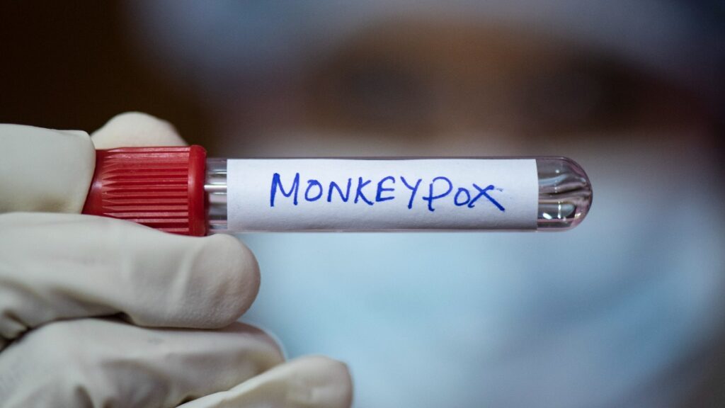 Viruela del mono en Uganda: registran dos primeros casos de mpox