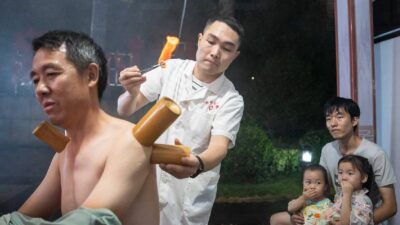 medicina tradicional china se moderniza