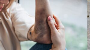 Mujer golpea a su cita por reclamarle que sus fotos tienen exceso de IA en Saltillo