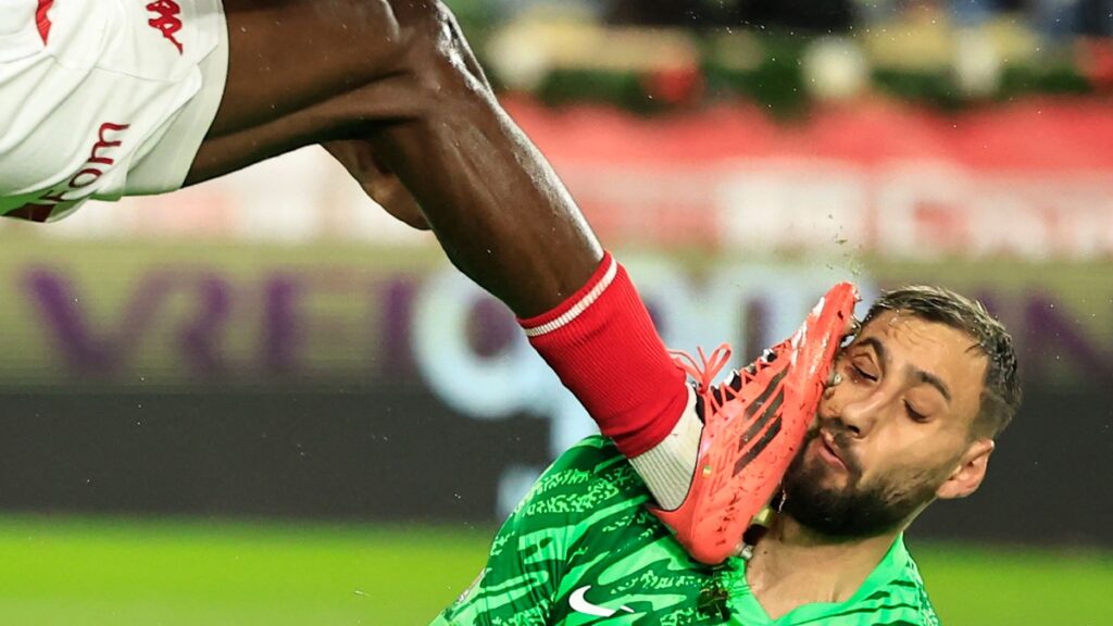 Donnarumma Patada Cara Herida