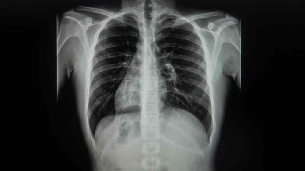 Situs inversus: ¿qué es esta condición en la que los órganos están en ...