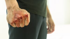 Alcalde de Pluma Hidalgo, Oaxaca, golpea a su tesorero por desvío de recursos