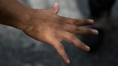 Una mujer en estado inconveniente intentó robar a un joven y le arrancó un dedo a mordidas en calles de Iztacalco, CDMX.