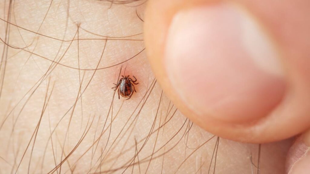 Picadura de garrapatas: ¿qué síndrome provoca y cuál es su relación con el consumo de carne?