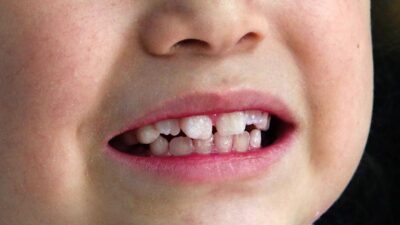 Cuidar la salud bucal de tus hijos desde temprana edad es clave para prevenir enfermedades graves y fomentar una buena calidad de vida.
