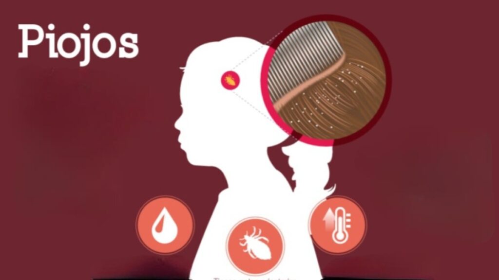 Muere Nino Por Piojos