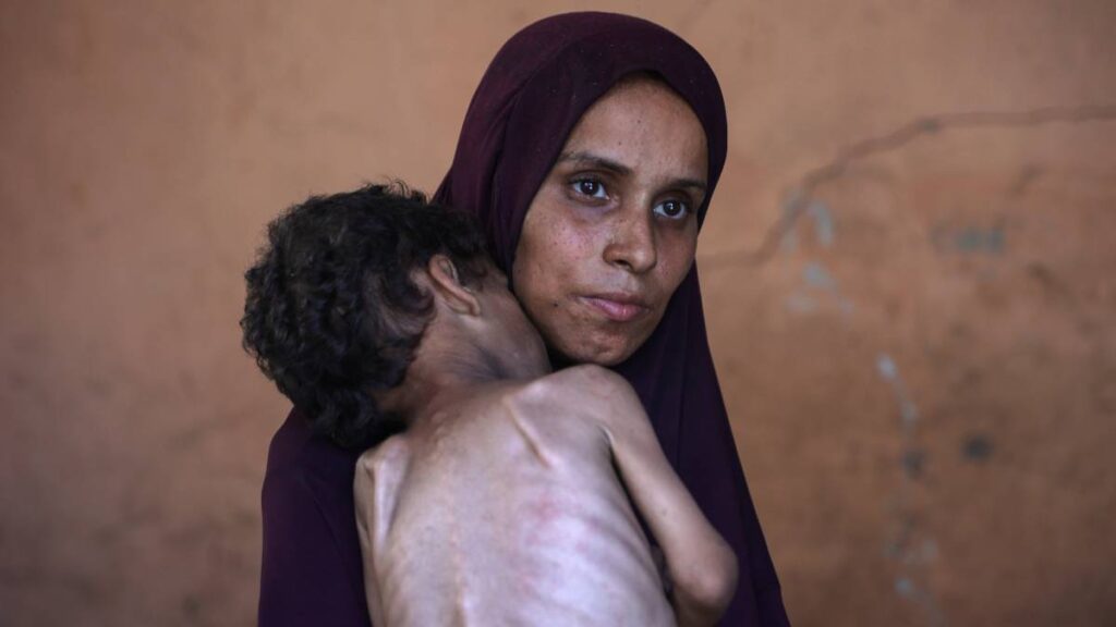 Gaza se muere de hambre
