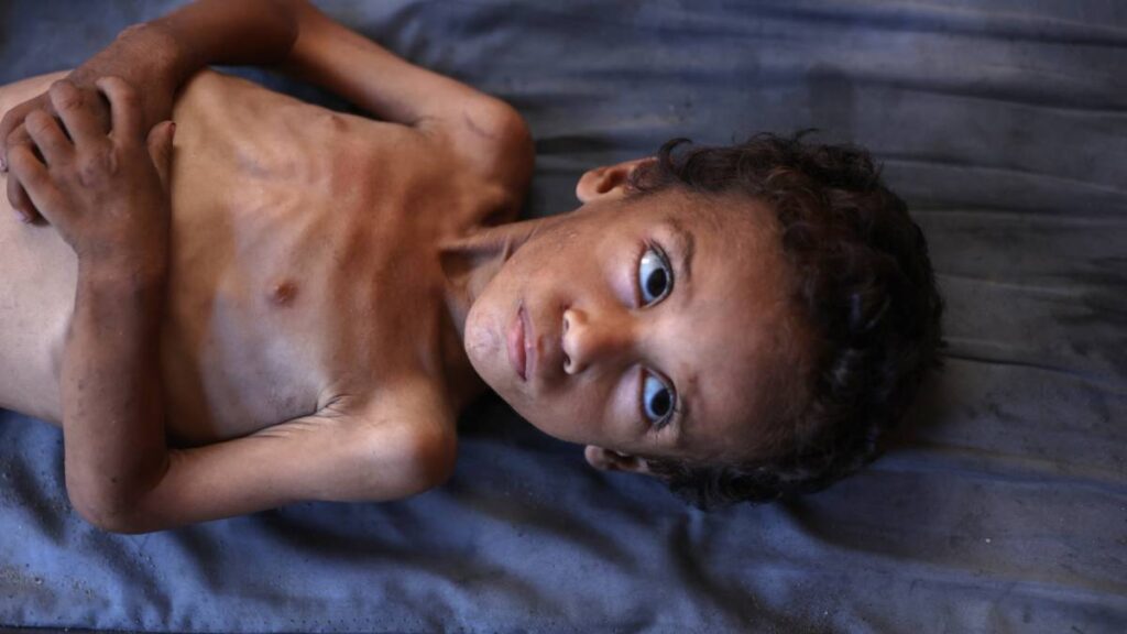 Gaza se muere de hambre