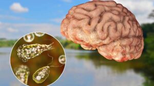 Amiba “come cerebros” y otros parásitos que pueden amenazar la salud en vacaciones