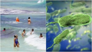 Alertan por bacteria “come carne”, cómo cuidarse en vacaciones