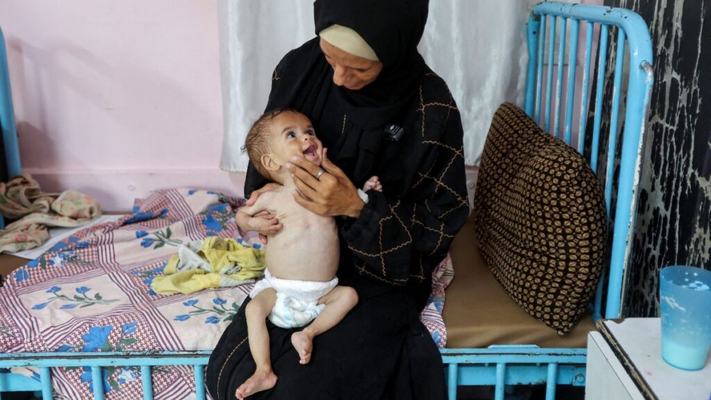 OMS alerta sobre una "hambruna masiva" en Gaza: ¿qué significa morir por inanición?