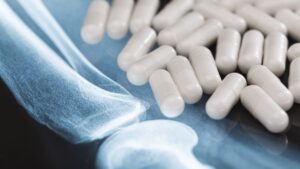 ¿Qué tan saludable es tomar glucosamina, el suplemento popular para dolor de rodilla?